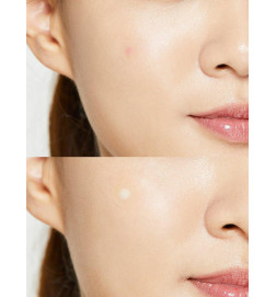 [COSRX] Acne Pimple Master 24 patches