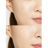 [COSRX] Acne Pimple Master 24 patches